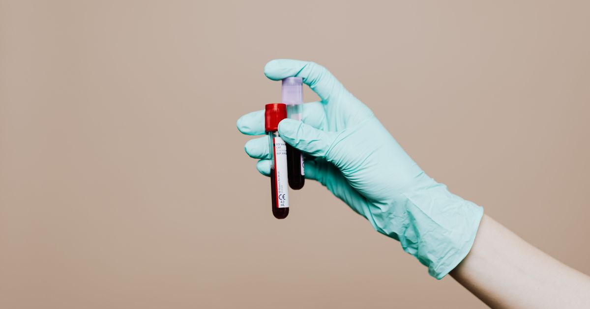 ¿Es posible detectar la enfermedad de Alzheimer con una prueba de sangre?